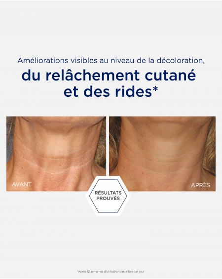Crème pour le cou et le décolleté Neostrata : aide à atténuer l'aspect des rides, des ridules et de la pigmentation irrégulière