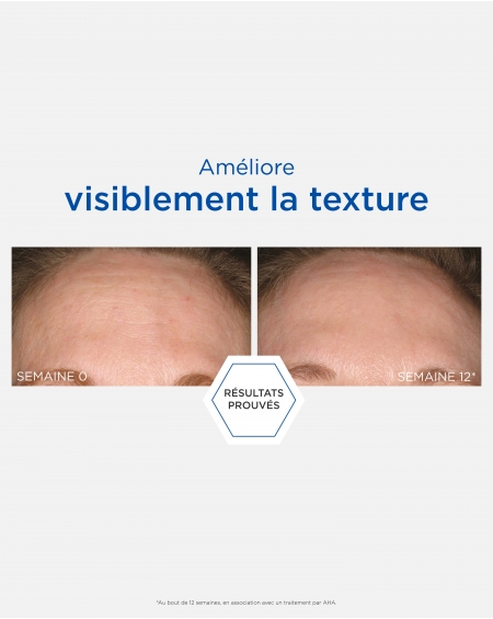 Peeling à l'acide glycolique Neostrata pour atténuer l'aspect des ridules, des pores dilatés et des rugosités