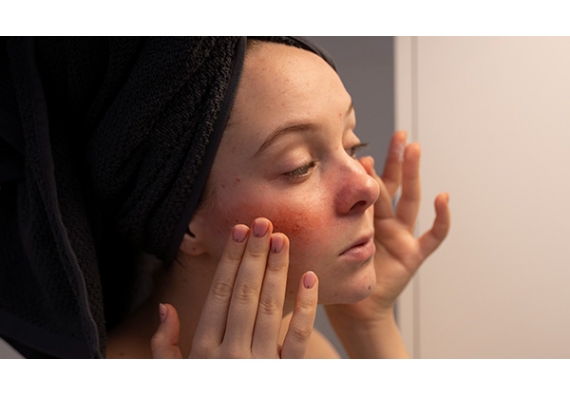 Pollution et stress oxydatif : quels impacts sur la peau et comment s’en protéger ?