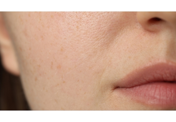 Peaux sensibles et vieillissement : Adopter une routine anti-âge sans irritation