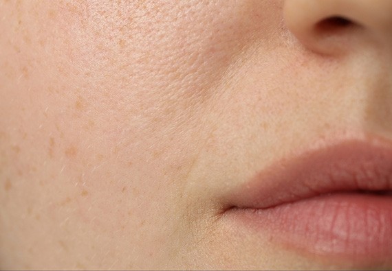 Quelles sont les causes de la peau sèche ?